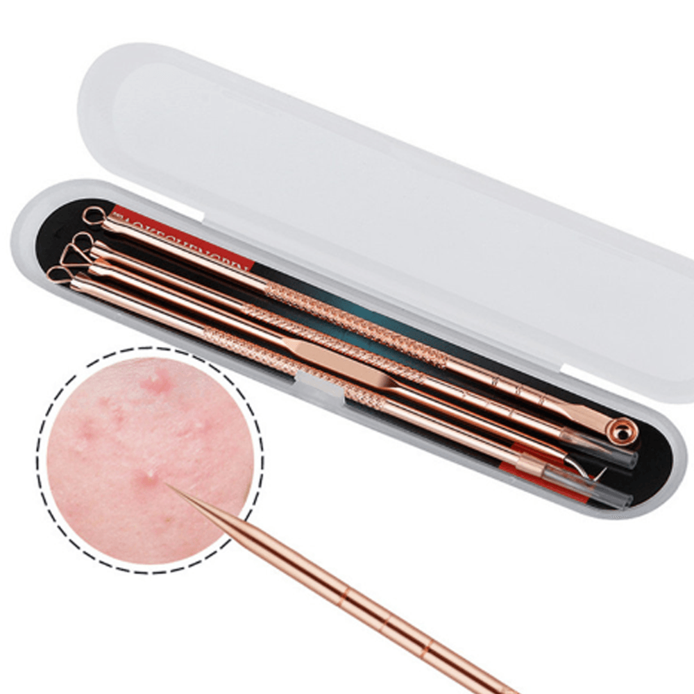 Rose Gold 4 Piece Blemish Extractor Set - Removal Tools