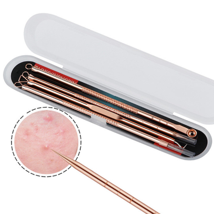 Rose Gold 4 Piece Blemish Extractor Set